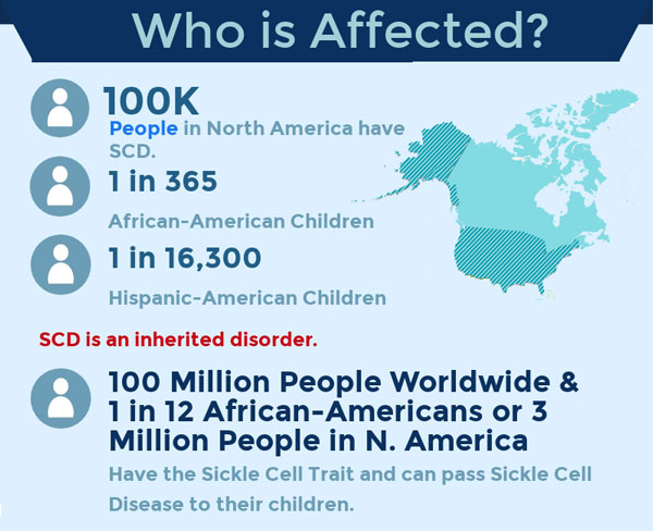 Who is affected by Sickle Cell Disease?